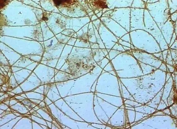 春夏交替,污泥膨脹怎么辦