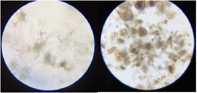 印染廢水庫巴魯COD激活菌前后污泥鏡檢比對